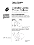 Tunneled Central Venous Catheter