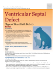 ventricular_septal_defect