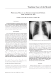 Pulmonary Mass in an Immunocompromised