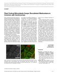 Plant Cortical Microtubule Arrays: Recruitment