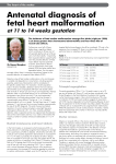 Antenatal diagnosis of fetal heart malformation