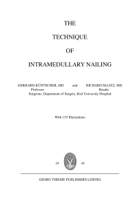 the technique of intramedullary nailing