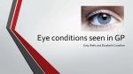 19.11.14 Common Eye Conditions in General Practice by Katy Wells