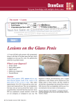 Lesions on the Glans Penis - STA HealthCare Communications
