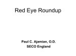 Red Eye Roundup