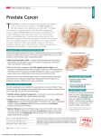 JAMA Patient Page | Prostate Cancer
