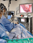 331: Innovations in Endoscopic Sinus Surgery