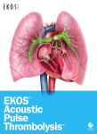 EKOS ® Acoustic Pulse Thrombolysis ™ Treatment