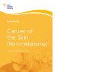 Understanding non-melanoma skin cancer