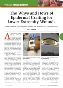 The Whys and Hows of Epidermal Grafting for Lower Extremity