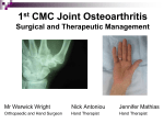 1st CMC Joint Osteoarthritis