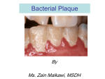 Bacterial Plaque