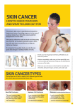 skin cancer