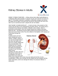 Kidney Stones in Adults
