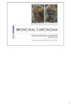 bronchial carcinoma - UCT Digital Pathology Teaching Collection