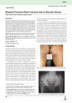 Bilateral Femoral Neck Fracture due to Electric Shock