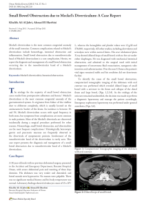 Small Bowel Obstruction due to Meckel`s Diverticulum: A Case Report