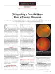 Distinguishing a Choroidal Nevus From a Choroidal Melanoma