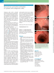 Mucosal tears and colonic perforation in a patient with collagenous