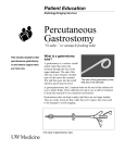 Percutaneous Gastrostomy