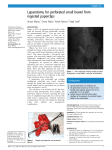 Laparotomy for perforated small bowel from ingested paperclips