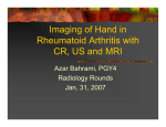 Imaging of bone erosion in Rheumatoid Arthritis