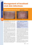 Management of localised viral skin infections