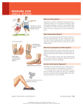 ankle sprain - KW Urgent Care Clinics