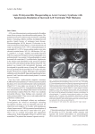 Acute Perimyocarditis Masquerading as Acute Coronary Syndrome