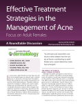 Effective Treatment Strategies in the Management of Acne