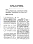 His Bundle Electrocardiography