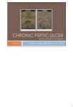 chronic peptic ulcer pm 1946-00248