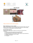 MRSA INFECTION - Zulekha Hospitals