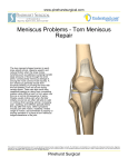 Meniscus Problems - Torn Meniscus Repair