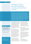 Differentiating between pressure ulcers and moisture