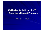 Catheter Ablation of VT in Structural Heart Disease