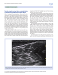 Dorsal scapular nerve injury: a complication of ultrasound