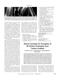 Neural correlates for perception of 3d surface orientation from texture