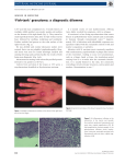 `Fish-tank` granuloma: a diagnostic dilemma