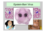 Epstein-Barr Virus - Academic lab pages