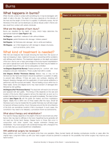 What happens in burns? - Massachusetts General Hospital