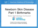 Newborn Skin Disease Part 1 Birthmarks