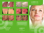 lumecca - InMode Aesthetic Solutions