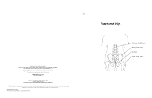 0342, Fractured Hip