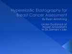 Hyperelastic Elastography in Breast Cancer Assessment.ppt