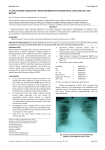 a case of mixed connective tissue disorder with interstitial lung disease