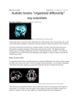 Autistic brains `organized differently`