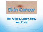 Skin Cancer - LifestylePP4