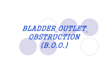 BLADDER OUTLET OBSTRUCTION