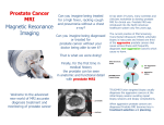 Prostate Cancer MRI